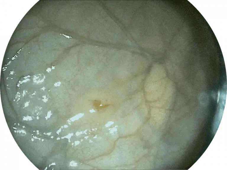 sonoscape-hybrid-color-imaging