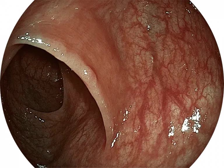 sonoscape-spectral-focused-imaging