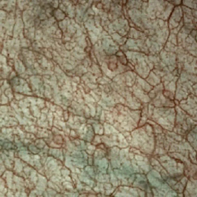 sonoscape-sri-disabled