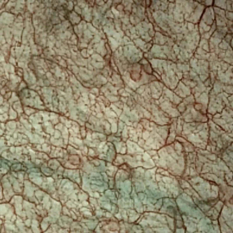 sonoscape-sri-enabled