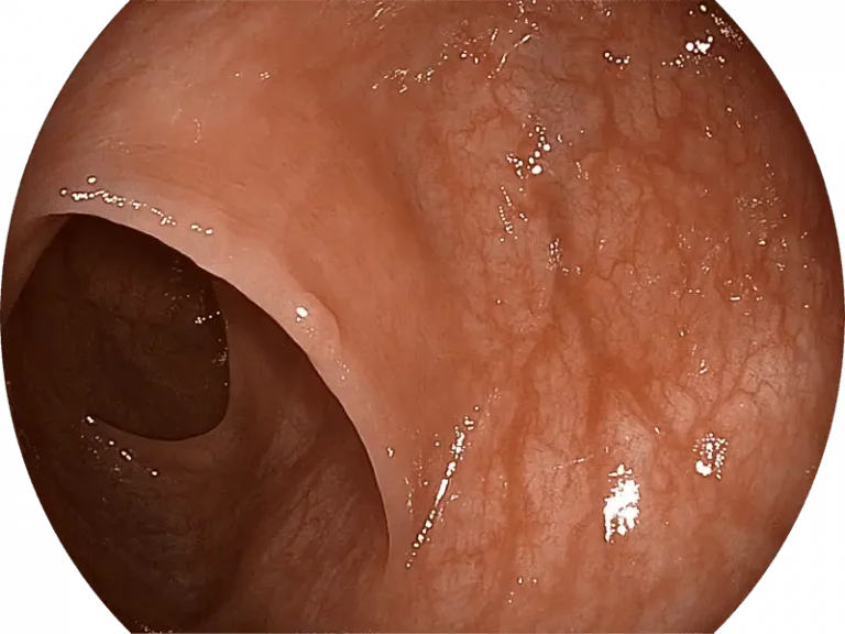 sonoscape-white-light