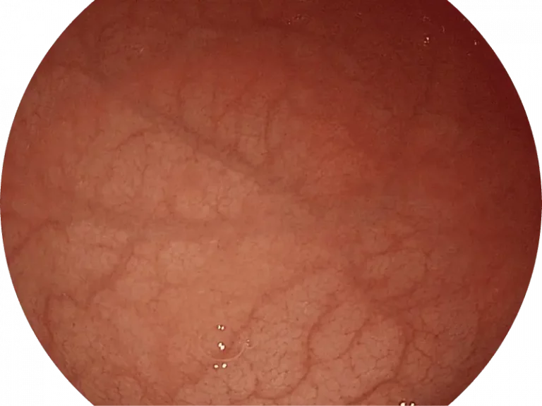 sonoscape-white-light_3